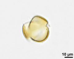 acetolyzed pollen, optical section