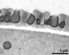 pollen wall, interapertural area