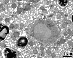 cytoplasm with generative cell  and organells