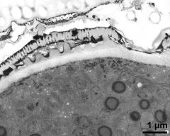 pollen wall with exine thickening at transition of aperture and interapertural area