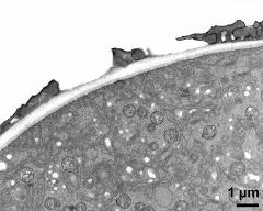 apertural area of pollen wall