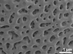 acetolyzed pollen,exine surface