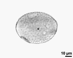 pollen grain with generative cell (asterisk)