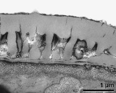 interapertural area of pollen wall