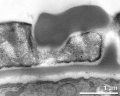 pollen wall, interapertural area