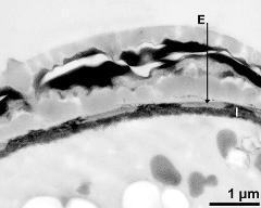 interapertural area of pollen wall, intine (I), endexine (E)