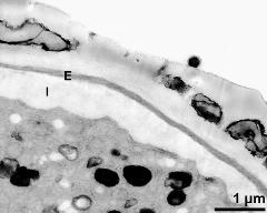 apertural area of pollen wall, intine (I), endexine (E)