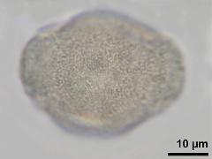 hydrated pollen,equatorial view