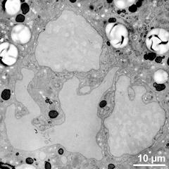 generative cell (left) and vegetative nucleus