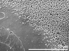 sulcus border