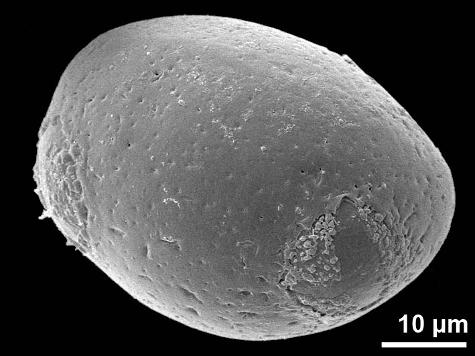 oblique distal polar view