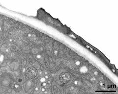 pollen wall at transition of aperture and interapertural area