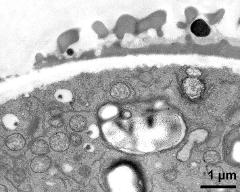 pollen wall at transition of aperture and interapertural area