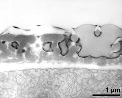 interapertural area of pollen wall