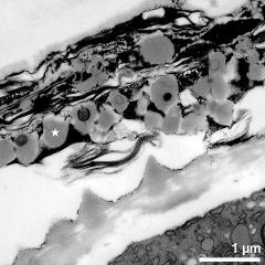 pollen wall and tapetum cells with Ubisch bodies (asterisk)