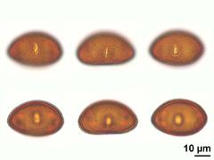 acetolyzed pollen,equatorial view