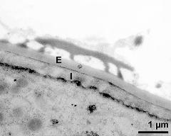 interapertural area of pollen wall, intine (I), endexine (E)