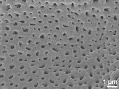 acetolyzed pollen,exine surface