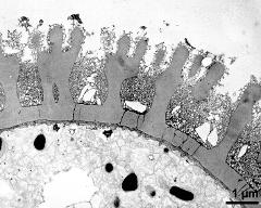pollen wall with perforated footlayer, exine cavities filled with pollen coating vesicles (PCV)