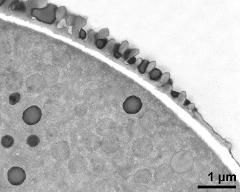 pollen wall at transition of aperture and interapertural region