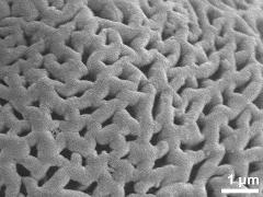 Sculpture in interapertural area