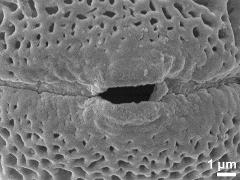 Sculpture along colpi,microreticulate