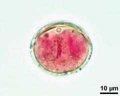 pollen grain with generative cell and vegetative nucleus