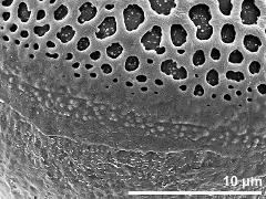 sulcus border