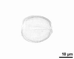 pollen grain after acetolysis