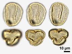 acetolyzed pollen,equatorial view,polar view