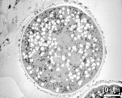 pollen grain in cross section