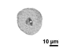 generative cell (asterisk) and vegetative nucleus