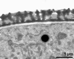 interapertural area of pollen wall