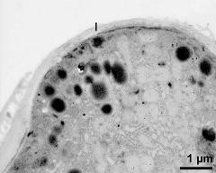 apertural area of pollen wall, intine (I)