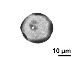 generative cell (asterisk) and vegetative nucleus