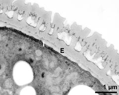 interapertural area of pollen wall, intine (I), endexine (E)