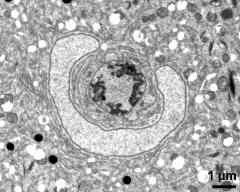 generative cell and vegetative nucleus