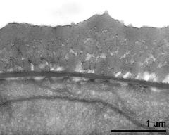 interapertural area of pollen wall