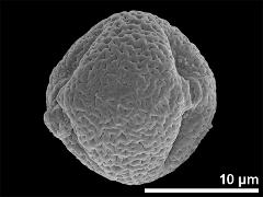 Equatorial view showing two apertures