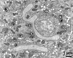 generative cell and vegetative nucleus