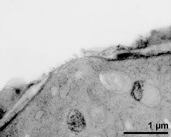 apertural area of pollen wall