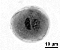 generattive cell (left) and vegetative nucleus