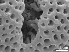 acetolyzed pollen,aperture detail,columellae