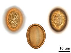 acetolyzed pollen,equatorial view