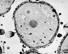 pollen grain in cross section