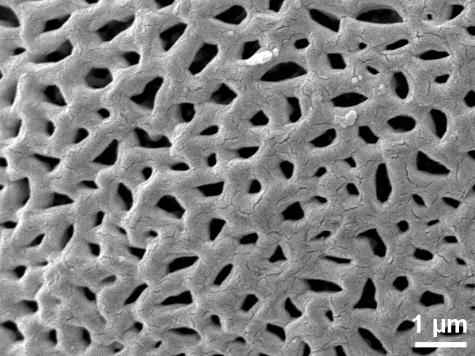 exine surface