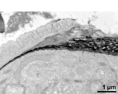 pollen wall, transition from aperture to interapertural area