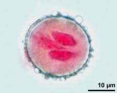 pollen grain with two sperm cells