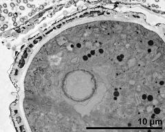 cross section of pollen grain