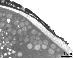 pollen wall at transition of aperture and interapertural area